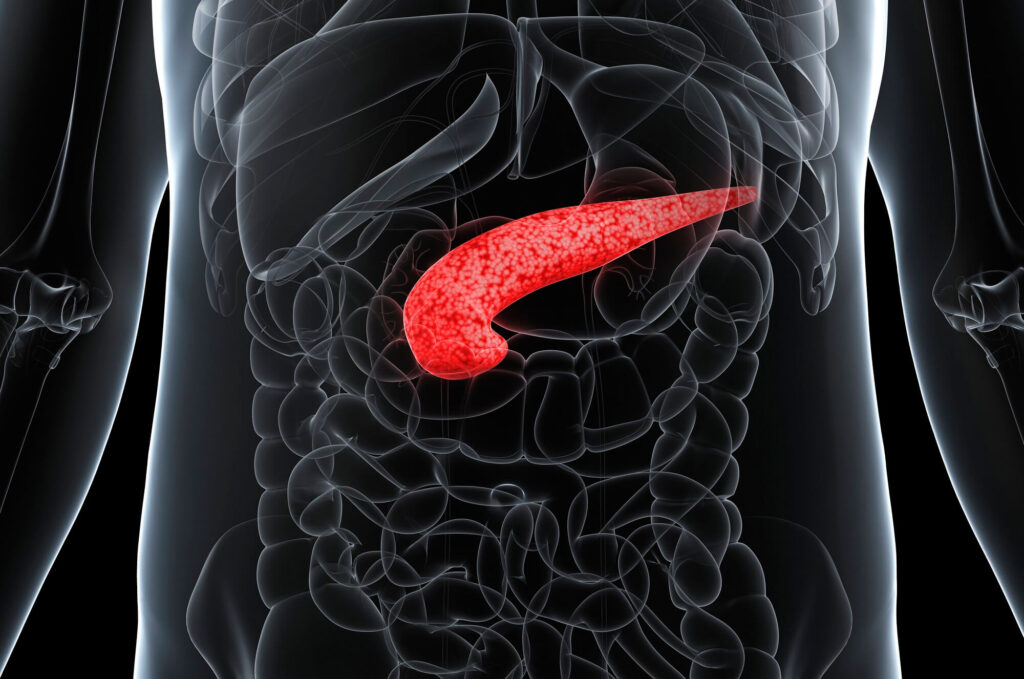 Ilustração do corpo humano destacando o pâncreas em vermelho, indicando foco em condição ou doença pancreática.