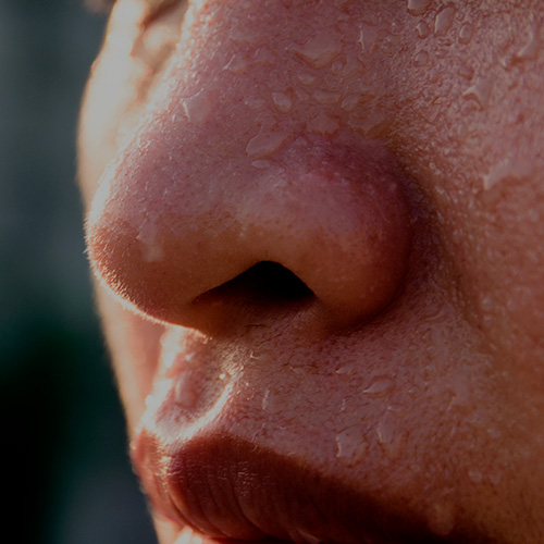Close no rosto de uma pessoa com pele descamando, evidenciando ressecamento ao redor do nariz e da boca.